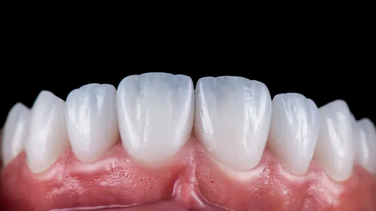 Best Cosmetic Dentistry in Poway