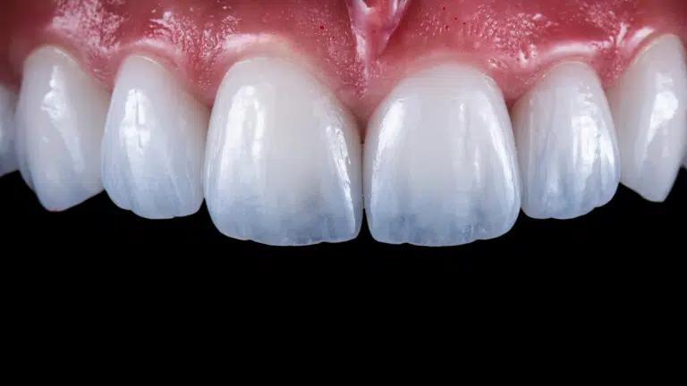 Best Cosmetic Dentistry in Poway